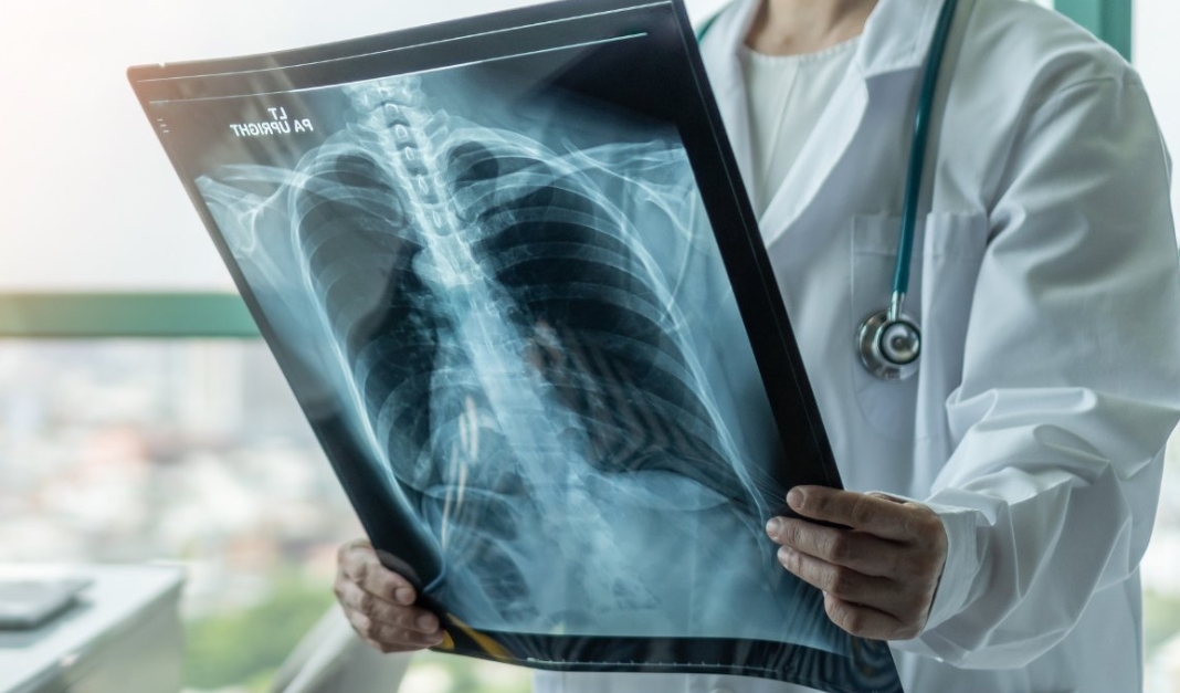 Investiga Cofece posibles acuerdos ilegales de material radiológico en sector salud